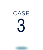 case3
